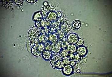 真菌孢子的显微镜照片