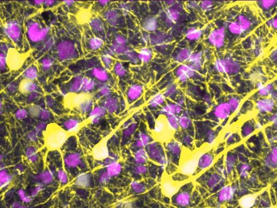 显微镜显示神经元之间的连接