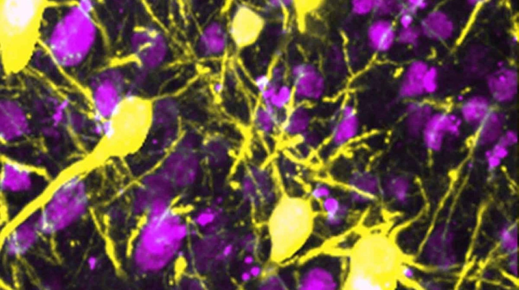 神经元成像为亮粉色和黄色