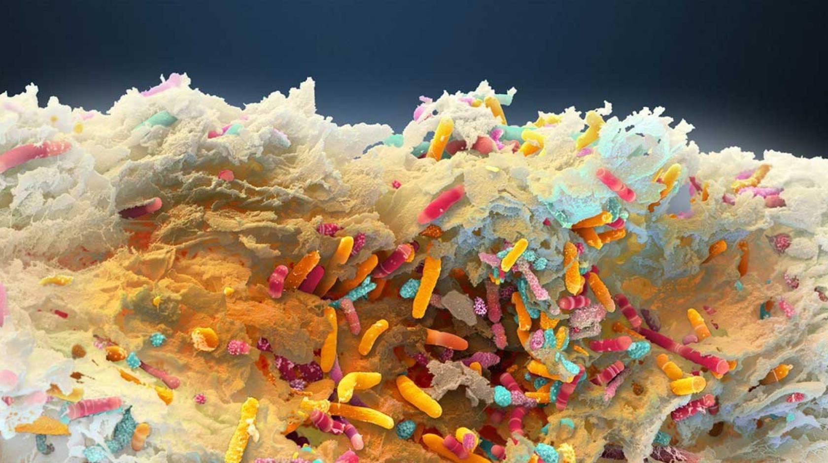 显微镜下看到的微生物群的彩色图像(看起来像地毯上的织物)
