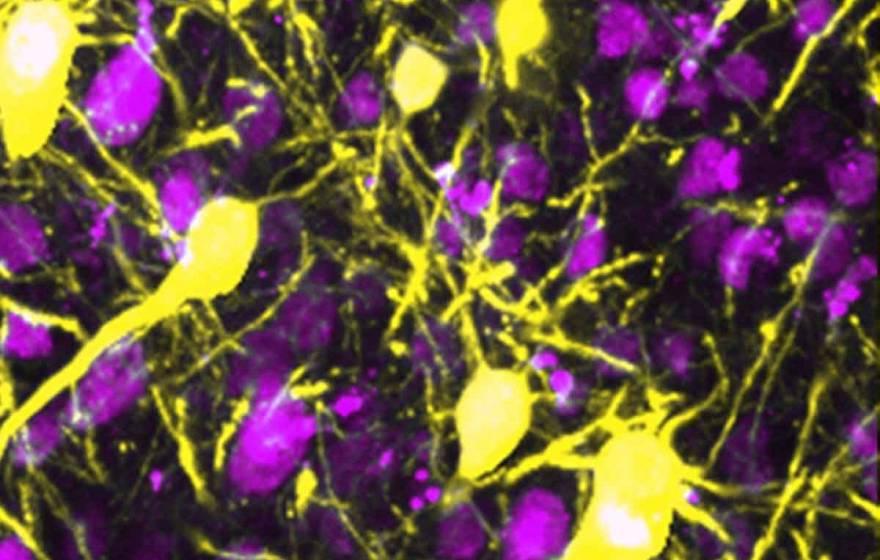 神经元成像为亮粉色和黄色
